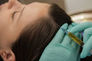 плазмотерапия волос винница